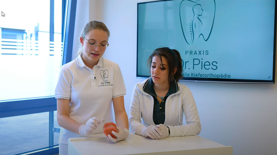 Was sind die Vorteile des Speed-Bracket-Systems?